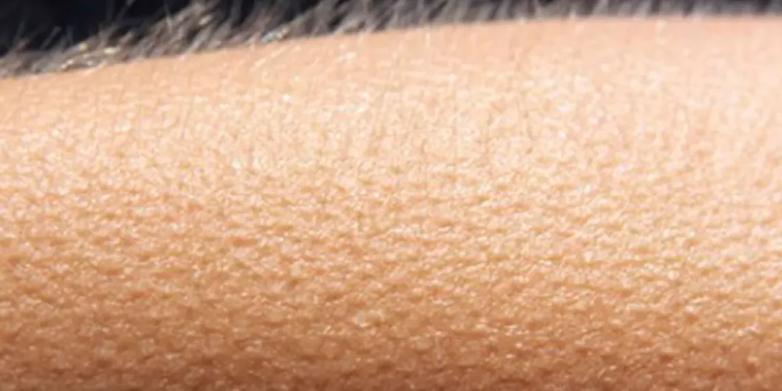 arrepiar musica close